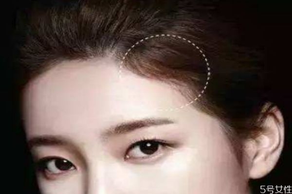 發(fā)際線高適合什么樣的發(fā)型 發(fā)際線后移怎么辦 發(fā)際線高適合什么樣的發(fā)型 發(fā)際線后移怎么辦