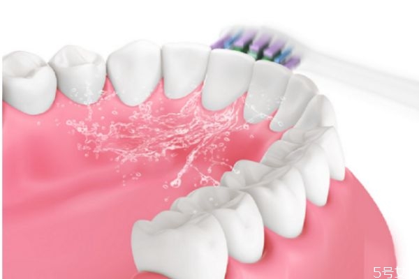 牙齒美白的小竅門有哪些 牙齒美白注意什么 牙齒美白的小竅門有哪些 牙齒美白注意什么