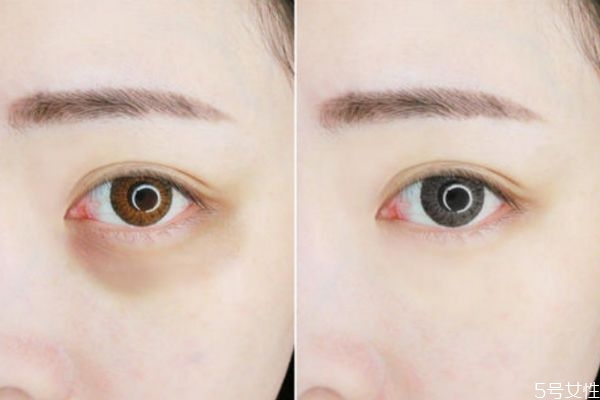 維生素e加凡士林可以去眼紋嗎 維生素e加凡士林要洗嗎 維生素e加凡士林可以去眼紋嗎 維生素e加凡士林要洗嗎