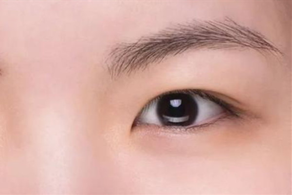 腫泡眼貼什么雙眼皮貼好 腫泡眼適合什么樣的雙眼皮貼 腫泡眼貼什么雙眼皮貼好 腫泡眼適合什么樣的雙眼皮貼