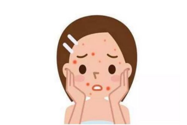 紅色痘印應(yīng)該怎么消除 消除紅色痘印的方法 紅色痘印應(yīng)該怎么消除 消除紅色痘印的方法