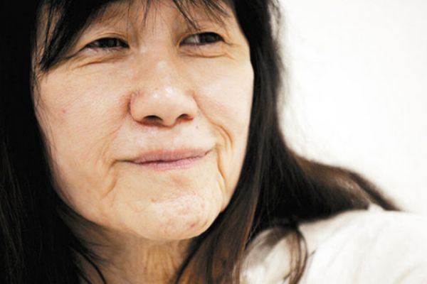 臉部松弛下垂怎么辦 如何改善臉部松弛下垂 臉部松弛下垂怎么辦 如何改善臉部松弛下垂