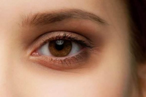 眼睛細紋怎么去掉 去掉眼睛細紋的方法 眼睛細紋怎么去掉 去掉眼睛細紋的方法