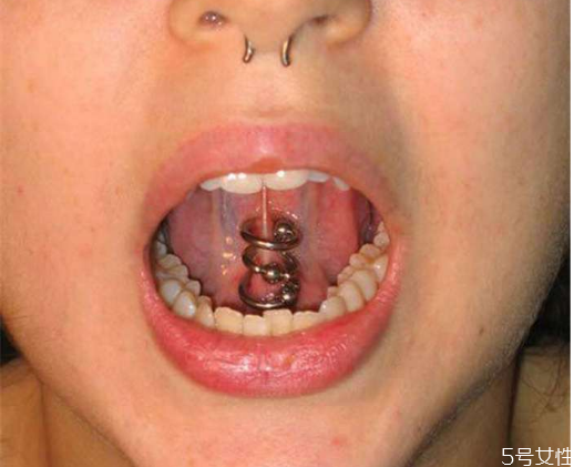 舌釘發(fā)炎了怎么辦 舌釘怎么護理 舌釘發(fā)炎了怎么辦 舌釘怎么護理