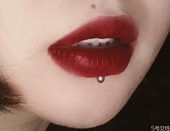 舌釘周圍一圈白色 舌釘增生了怎么去除 舌釘周圍一圈白色 舌釘增生了怎么去除