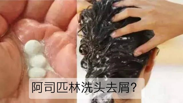 洗頭發(fā)加阿司匹林有什么好處及效果 洗頭發(fā)加阿司匹林有什么好處及效果