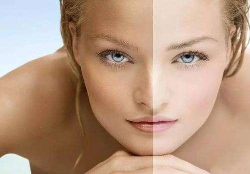 臉部皮膚暗黃怎么變白 臉部皮膚變得暗黃怎么解決 臉部皮膚暗黃怎么變白 臉部皮膚變得暗黃怎么解決