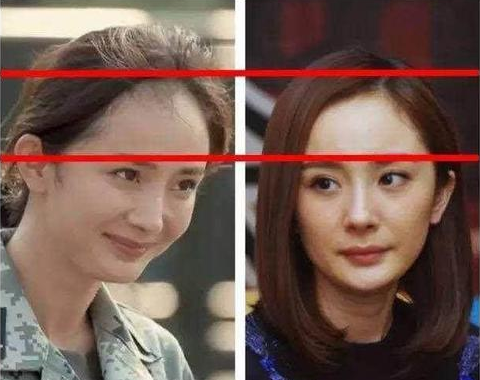 怎么解決發(fā)際線后移 發(fā)際線后移我們該如何挽救 怎么解決發(fā)際線后移 發(fā)際線后移我們該如何挽救