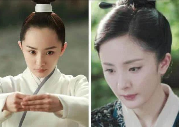 怎么解決發(fā)際線后移 發(fā)際線后移我們該如何挽救 怎么解決發(fā)際線后移 發(fā)際線后移我們該如何挽救