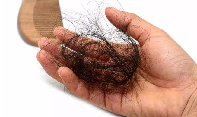 經常掉頭發(fā)的人身體是缺什么營養(yǎng) 經常掉頭發(fā)的人身體是缺什么營養(yǎng)