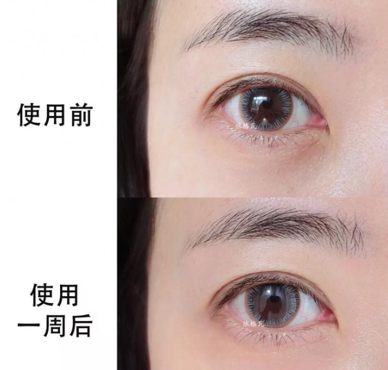 護(hù)膚與不護(hù)膚的區(qū)別圖 護(hù)膚與不護(hù)膚的對(duì)比差距大嗎 護(hù)膚與不護(hù)膚的區(qū)別圖 護(hù)膚與不護(hù)膚的對(duì)比差距大嗎