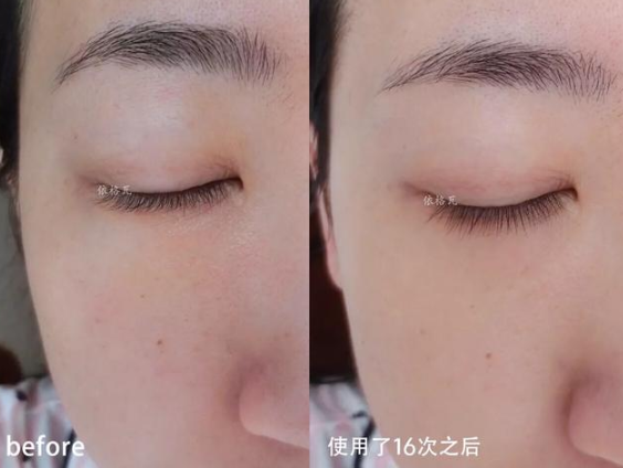 護(hù)膚與不護(hù)膚的區(qū)別圖 護(hù)膚與不護(hù)膚的對(duì)比差距大嗎 護(hù)膚與不護(hù)膚的區(qū)別圖 護(hù)膚與不護(hù)膚的對(duì)比差距大嗎