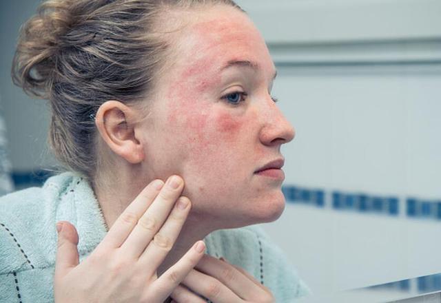 敏感肌怎么判斷 敏感肌膚修復(fù)方法 敏感肌怎么判斷 敏感肌膚修復(fù)方法