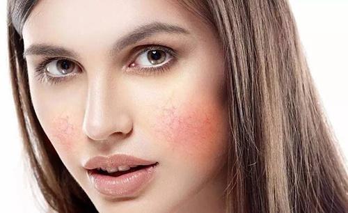 敏感肌怎么判斷 敏感肌膚修復(fù)方法 敏感肌怎么判斷 敏感肌膚修復(fù)方法