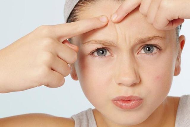 如何預(yù)防粉刺閉口 怎么去除粉刺 如何預(yù)防粉刺閉口 怎么去除粉刺