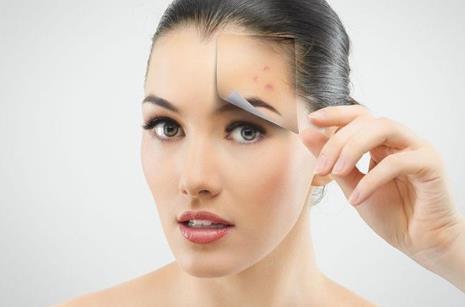 如何預(yù)防粉刺閉口 怎么去除粉刺 如何預(yù)防粉刺閉口 怎么去除粉刺