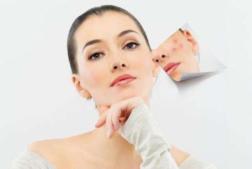 如何預(yù)防粉刺閉口 怎么去除粉刺 如何預(yù)防粉刺閉口 怎么去除粉刺