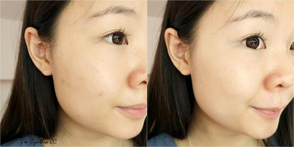 控油是不是去油的意思 怎樣面部控油最有效 控油是不是去油的意思 怎樣面部控油最有效