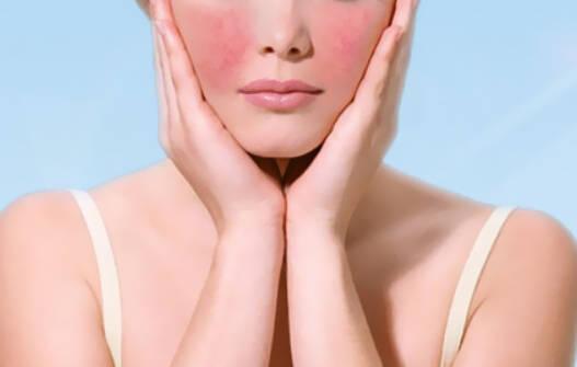 敏感肌臉頰泛紅怎么修復 敏感肌怎么修復成正常肌膚 敏感肌臉頰泛紅怎么修復 敏感肌怎么修復成正常肌膚