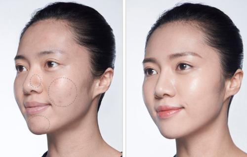 遮瑕在粉底前還是在粉底后 遮瑕能遮住疤痕嗎 遮瑕在粉底前還是在粉底后 遮瑕能遮住疤痕嗎