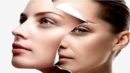 臉部松弛下垂如何改善 臉部為何會松弛 臉部松弛下垂如何改善 臉部為何會松弛