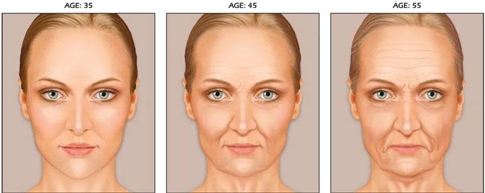 臉部松弛下垂如何改善 臉部為何會松弛 臉部松弛下垂如何改善 臉部為何會松弛