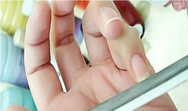 貼片甲的卸除方法 貼片甲怎么卸 貼片甲的卸除方法 貼片甲怎么卸