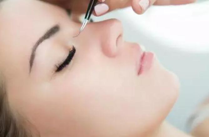 種睫毛眼皮過敏紅腫癢怎么辦 種睫毛眼皮腫了幾天能好 種睫毛眼皮過敏紅腫癢怎么辦 種睫毛眼皮腫了幾天能好