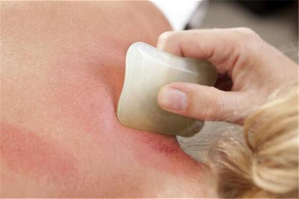 刮痧能祛濕嗎 刮痧多久一次合適 刮痧能祛濕嗎 刮痧多久一次合適