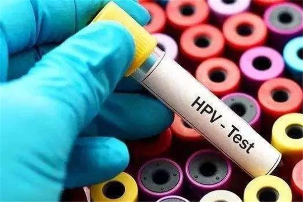 宮頸癌疫苗和新冠疫苗有沖突嗎 宮頸癌疫苗可以和新冠疫苗一起打嗎 宮頸癌疫苗和新冠疫苗有沖突嗎 宮頸癌疫苗可以和新冠疫苗一起打嗎