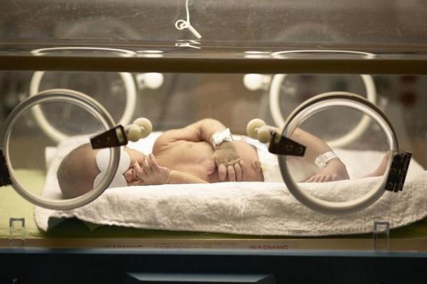 新生兒黃疸吃什么藥 新生兒黃疸的檢測(cè)方法 新生兒黃疸吃什么藥 新生兒黃疸的檢測(cè)方法