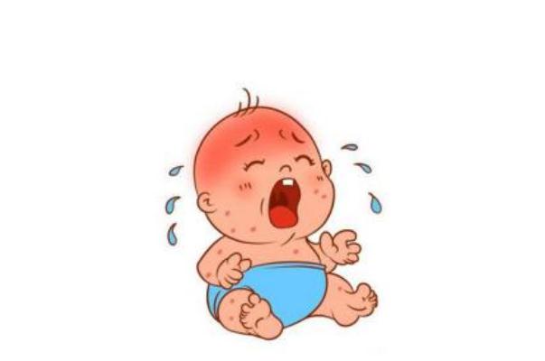 嬰兒濕疹反復(fù)發(fā)作原因 嬰兒濕疹怎么治才能好得快 嬰兒濕疹反復(fù)發(fā)作原因 嬰兒濕疹怎么治才能好得快