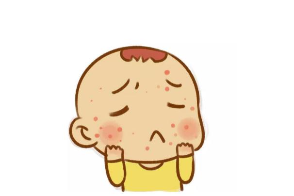 嬰兒濕疹是奶粉過敏嗎 寶寶奶粉過敏會起濕疹嗎 嬰兒濕疹是奶粉過敏嗎 寶寶奶粉過敏會起濕疹嗎