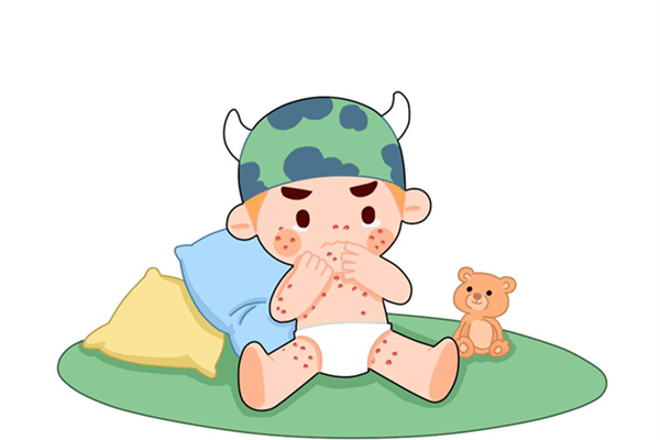 寶寶起痱子怎么辦 寶寶起痱子可以用花露水嗎 寶寶起痱子怎么辦 寶寶起痱子可以用花露水嗎