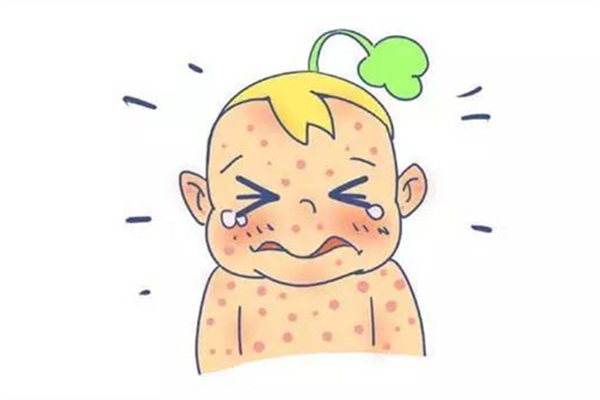 寶寶一般什么時候長水痘 寶寶長水痘的癥狀 寶寶一般什么時候長水痘 寶寶長水痘的癥狀