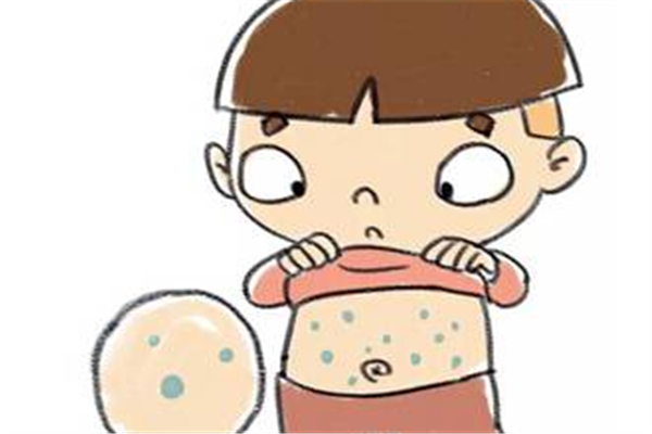 寶寶一般什么時候長水痘 寶寶長水痘的癥狀 寶寶一般什么時候長水痘 寶寶長水痘的癥狀