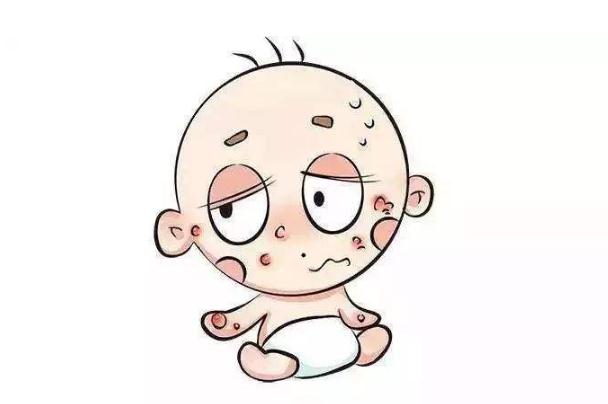 嬰兒濕疹要好的癥狀有哪些 嬰兒濕疹要涂保濕霜嗎 嬰兒濕疹要好的癥狀有哪些 嬰兒濕疹要涂保濕霜嗎
