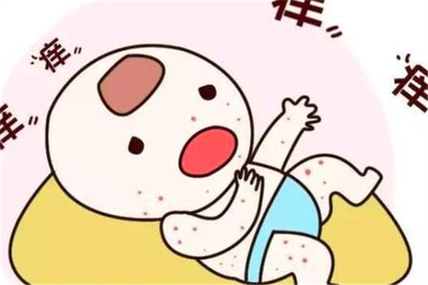 寶寶起痱子怎么辦 寶寶起痱子可以用花露水嗎 寶寶起痱子怎么辦 寶寶起痱子可以用花露水嗎