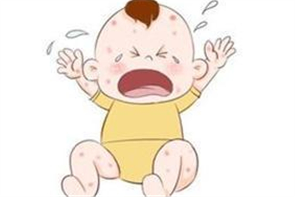 寶寶起痱子怎么辦 寶寶起痱子可以用花露水嗎 寶寶起痱子怎么辦 寶寶起痱子可以用花露水嗎