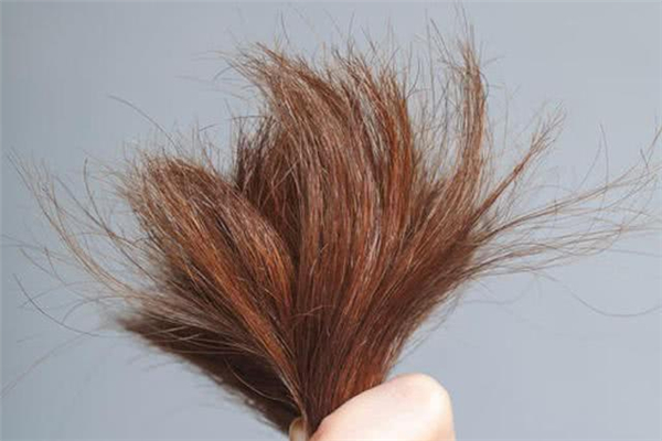 頭發(fā)有分叉怎么辦 頭發(fā)有分叉怎么護理 頭發(fā)有分叉怎么辦 頭發(fā)有分叉怎么護理