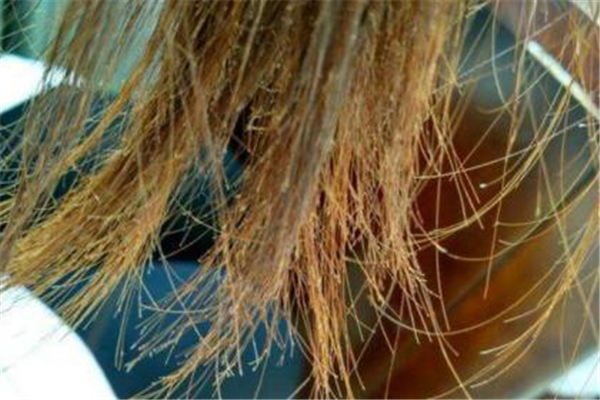 頭發(fā)有分叉怎么辦 頭發(fā)有分叉怎么護理 頭發(fā)有分叉怎么辦 頭發(fā)有分叉怎么護理