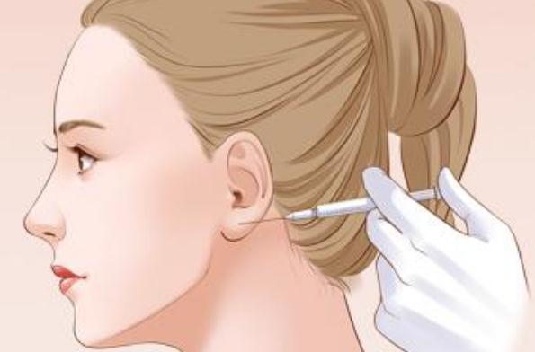 瘦臉針的功效和作用 瘦臉針打一次一般能保持多久 瘦臉針的功效和作用 瘦臉針打一次一般能保持多久