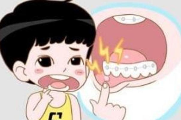 口腔潰瘍可以吃海鮮嗎 口腔潰瘍可以吃荔枝嗎 口腔潰瘍可以吃海鮮嗎 口腔潰瘍可以吃荔枝嗎