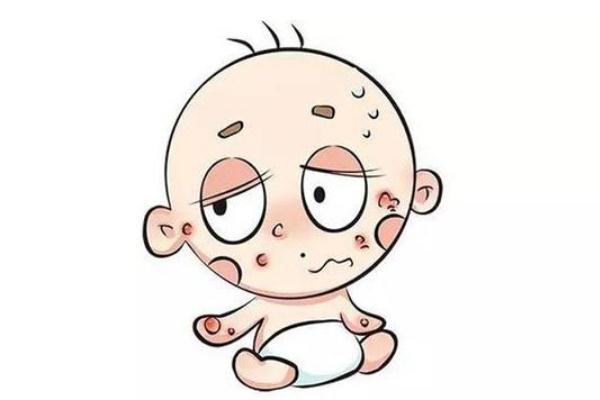 孩子過(guò)敏的癥狀有哪些 孩子過(guò)敏的原因 孩子過(guò)敏的癥狀有哪些 孩子過(guò)敏的原因