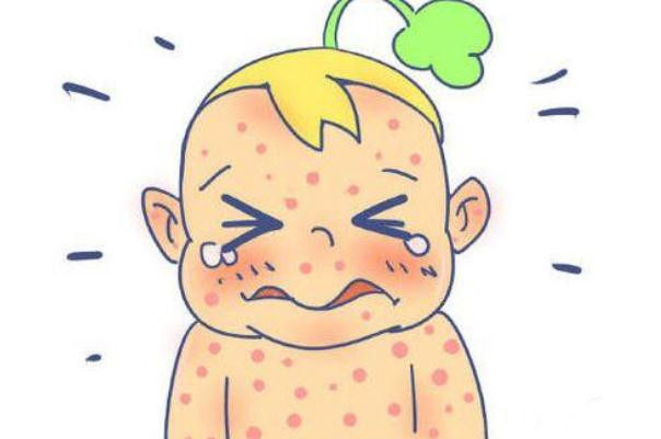 孩子過敏要去醫(yī)院嗎 孩子過敏要吃什么藥 孩子過敏要去醫(yī)院嗎 孩子過敏要吃什么藥