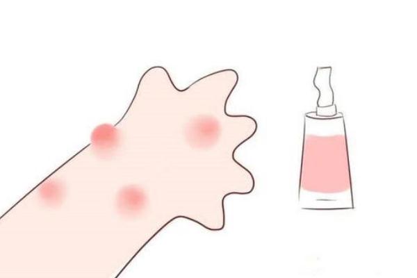 孩子過敏要去醫(yī)院嗎 孩子過敏要吃什么藥 孩子過敏要去醫(yī)院嗎 孩子過敏要吃什么藥