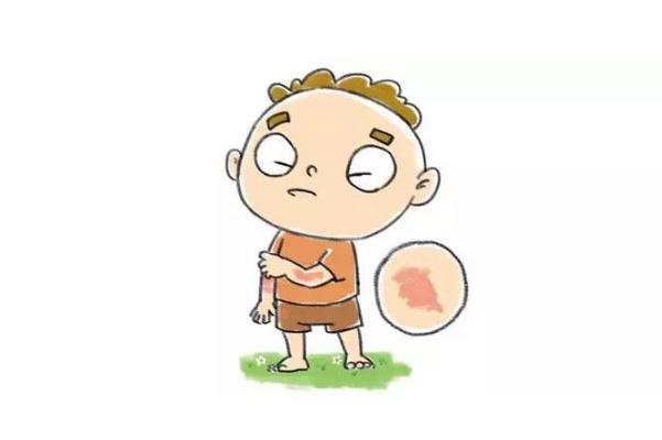 蕁麻疹是什么原因引起的 蕁麻疹怎么治療能除根 蕁麻疹是什么原因引起的 蕁麻疹怎么治療能除根