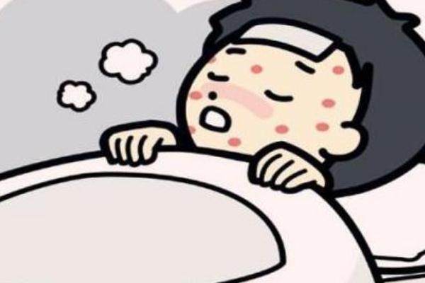 蕁麻疹可以吹風(fēng)不 蕁麻疹可以吃魚嗎 蕁麻疹可以吹風(fēng)不 蕁麻疹可以吃魚嗎