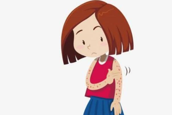 蕁麻疹對(duì)生育有影響嗎 蕁麻疹對(duì)胎兒發(fā)育有影響嗎 蕁麻疹對(duì)生育有影響嗎 蕁麻疹對(duì)胎兒發(fā)育有影響嗎