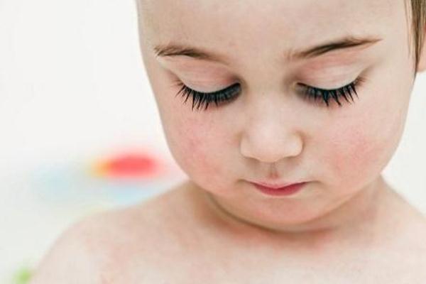 新生兒濕疹是熱出來(lái)的嗎 新生兒濕疹是胎毒引起的嗎 新生兒濕疹是熱出來(lái)的嗎 新生兒濕疹是胎毒引起的嗎